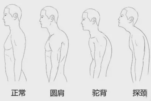 21天改善圆肩驼背特训营【完结】